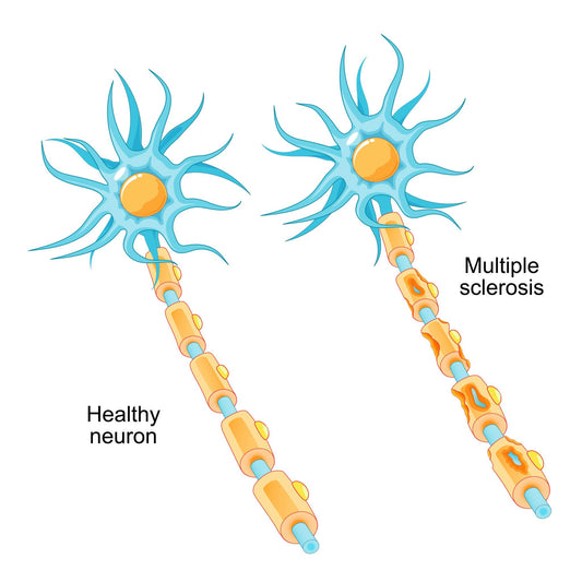 Blog about why there is still no cure for MS
